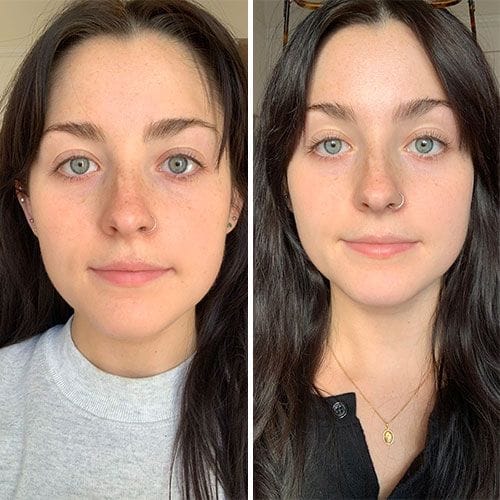 Before and after result 2
